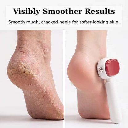 🦶 Double-Sided Foot File for Callus Removal